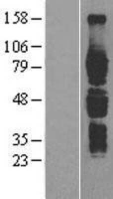 Western Blot: IL6R Overexpression Lysate [NBP2-04164]