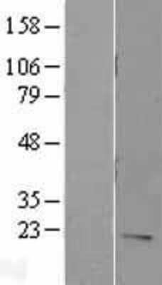 Western Blot: IL-7 Overexpression Lysate [NBL1-11965]