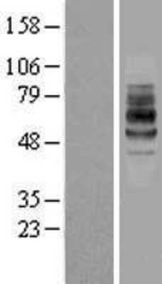 Western Blot: IL-7R alpha/CD127 Overexpression Lysate [NBL1-11966]