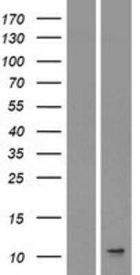 Western Blot: CXCL8/IL-8 Overexpression Lysate [NBP2-04166]