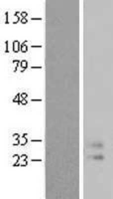 Western Blot: IL-9 Overexpression Lysate [NBL1-11970]