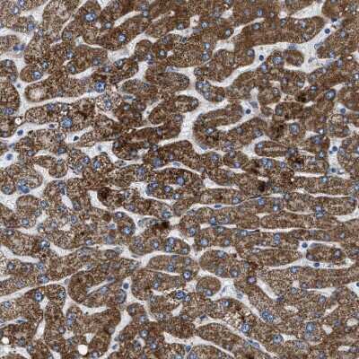 Immunohistochemistry-Paraffin: ILDR1 Antibody [NBP1-85236]