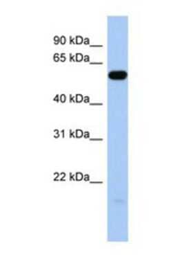 Western Blot: ILDR1 Antibody [NBP1-69697]