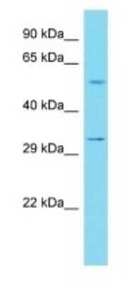 Western Blot: ILDR2 Antibody [NBP3-09736]