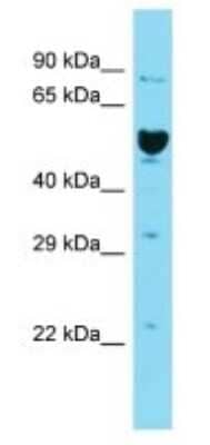 Western Blot: ILDR2 Antibody [NBP3-09737]