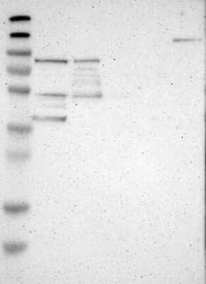 Western Blot: ILDR2 Antibody [NBP3-17506]