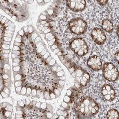 Immunohistochemistry-Paraffin: ILF1 Antibody [NBP1-87700]