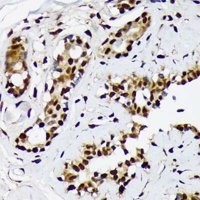 Immunohistochemistry-Paraffin: ILF2 Antibody (5P1K2) [NBP3-16819]