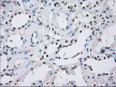 Immunohistochemistry-Paraffin: ILF2 Antibody (OTI6F1) [NBP1-47811]