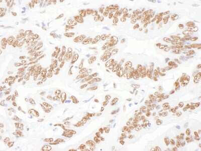 Immunohistochemistry: ILF2 Antibody [NBP1-71902]