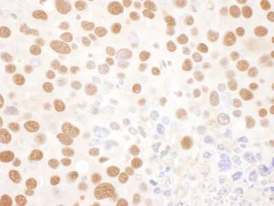 Immunohistochemistry: ILF2 Antibody [NBP1-71902]