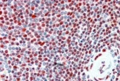 Immunohistochemistry-Paraffin: ILF2 Antibody [NBP1-00204]