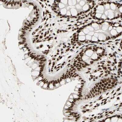 Immunohistochemistry-Paraffin: ILF2 Antibody [NBP1-82586]