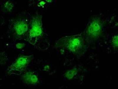 Immunocytochemistry/ Immunofluorescence: ILF2 Antibody (OTI6F1) - Azide and BSA Free [NBP2-71036]