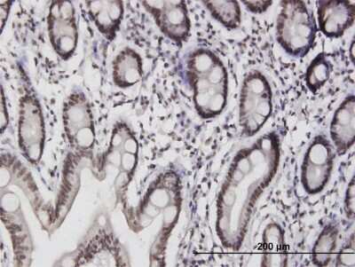 Immunohistochemistry-Paraffin: ILF3 Antibody [H00003609-B01P]
