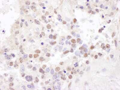 Immunohistochemistry-Paraffin: ILF3 Antibody [NBP1-71876]