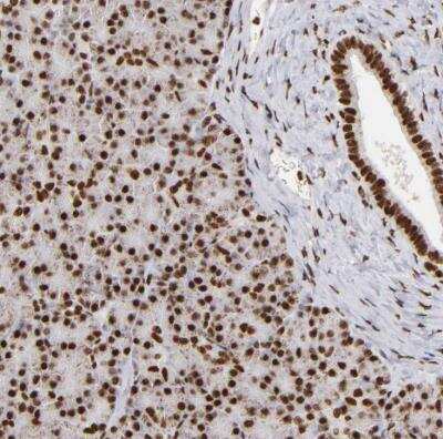 Immunohistochemistry-Paraffin: ILF3 Antibody [NBP1-84056]