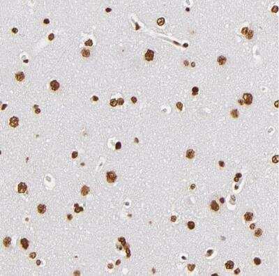 Immunohistochemistry-Paraffin: ILF3 Antibody [NBP1-84056]