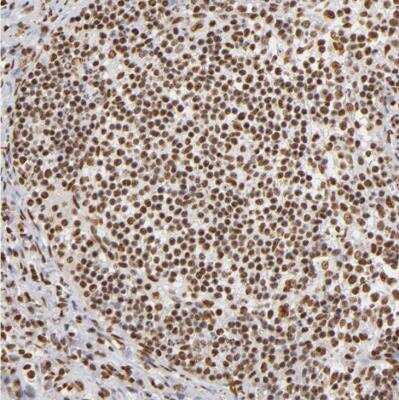 Immunohistochemistry-Paraffin: ILF3 Antibody [NBP1-84056]