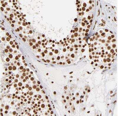 Immunohistochemistry-Paraffin: ILF3 Antibody [NBP1-84056]