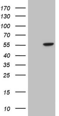 Western Blot: ILK Antibody (OTI2H3) [NBP2-45415]