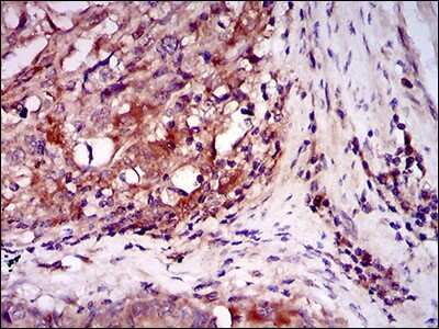 Immunohistochemistry-Paraffin: ILK Antibody (3A9) - BSA Free [NBP2-37448]