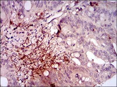 Immunohistochemistry-Paraffin: ILK Antibody (3A9) - BSA Free [NBP2-37448]