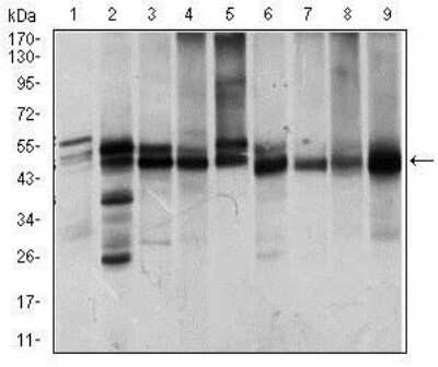 Western Blot: ILK Antibody (3A9)BSA Free [NBP2-37448]