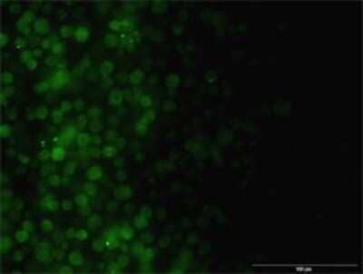 Immunocytochemistry/ Immunofluorescence: ILK Antibody (4F10) [H00003611-M01]