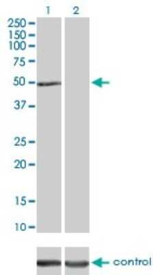 Western Blot: ILK Antibody (4F10) [H00003611-M01]
