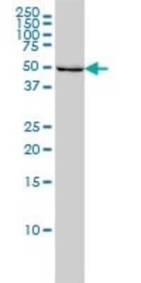 Western Blot: ILK Antibody (4F10) [H00003611-M01]