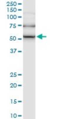 Western Blot: ILK Antibody (4F10) [H00003611-M01]