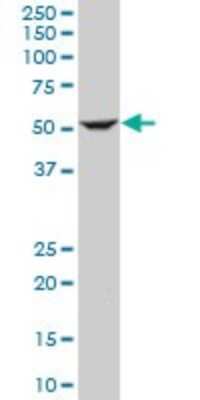 Western Blot: ILK Antibody (4F10) [H00003611-M01]