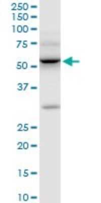 Western Blot: ILK Antibody (4F10) [H00003611-M01]