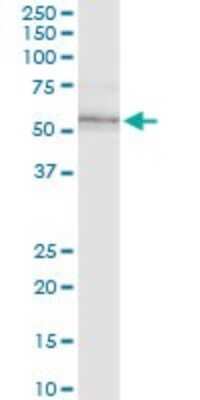 Western Blot: ILK Antibody (4F10) [H00003611-M01]
