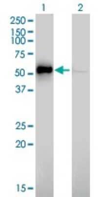 Western Blot: ILK Antibody (4F10) [H00003611-M01]