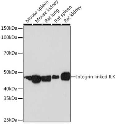 Western Blot: ILK Antibody (5R10U3) [NBP3-16439]