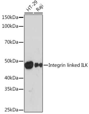 Western Blot: ILK Antibody (5R10U3) [NBP3-16439]