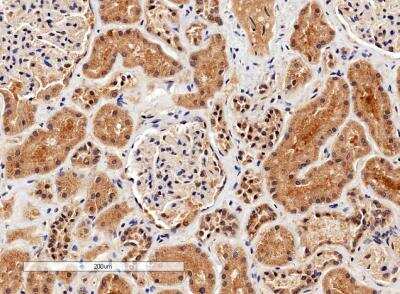 Immunohistochemistry-Paraffin: ILK Antibody [NB100-809]
