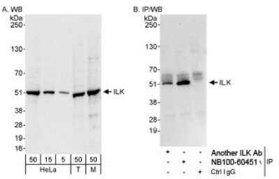 Western Blot: ILK Antibody [NB100-60451]