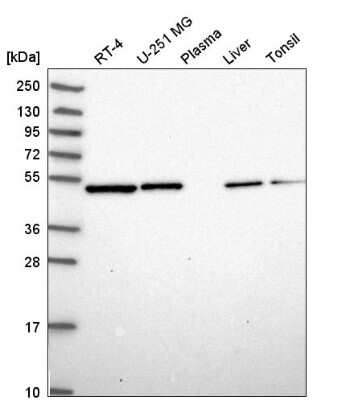 Western Blot: ILK Antibody [NBP2-55514]