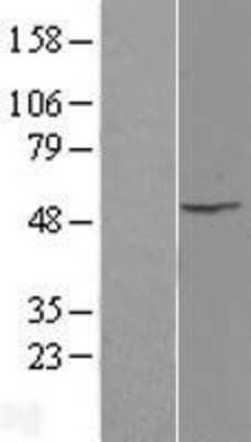 Western Blot: ILK Overexpression Lysate [NBL1-11974]