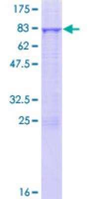 SDS-PAGE: Recombinant Human ILK GST (N-Term) Protein [H00003611-P01]