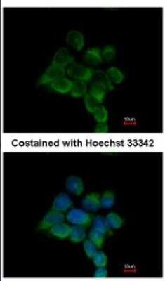 Immunocytochemistry/ Immunofluorescence: ILKAP/PP2C delta Antibody [NBP2-16960]