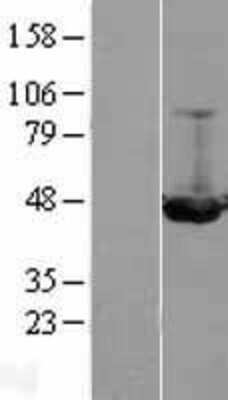 Western Blot: ILKAP/PP2C delta Overexpression Lysate [NBL1-11976]