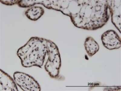 Immunohistochemistry-Paraffin: ILKAP/PP2C delta Antibody (3B5) [H00080895-M02]