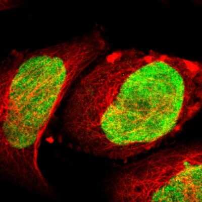 Immunocytochemistry/ Immunofluorescence: ILKAP/PP2C delta Antibody [NBP1-85117]