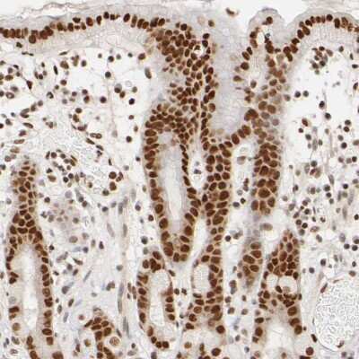 Immunohistochemistry-Paraffin: ILKAP/PP2C delta Antibody [NBP1-85117]