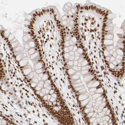 Immunohistochemistry-Paraffin: ILKAP/PP2C delta Antibody [NBP1-85117]
