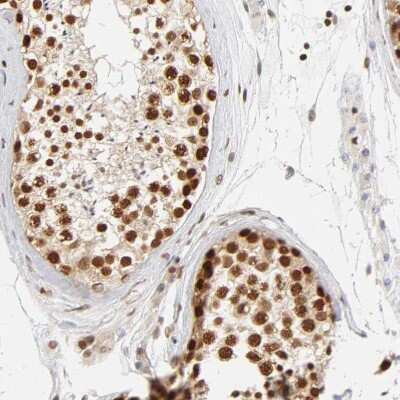 Immunohistochemistry-Paraffin: ILKAP/PP2C delta Antibody [NBP1-85117]